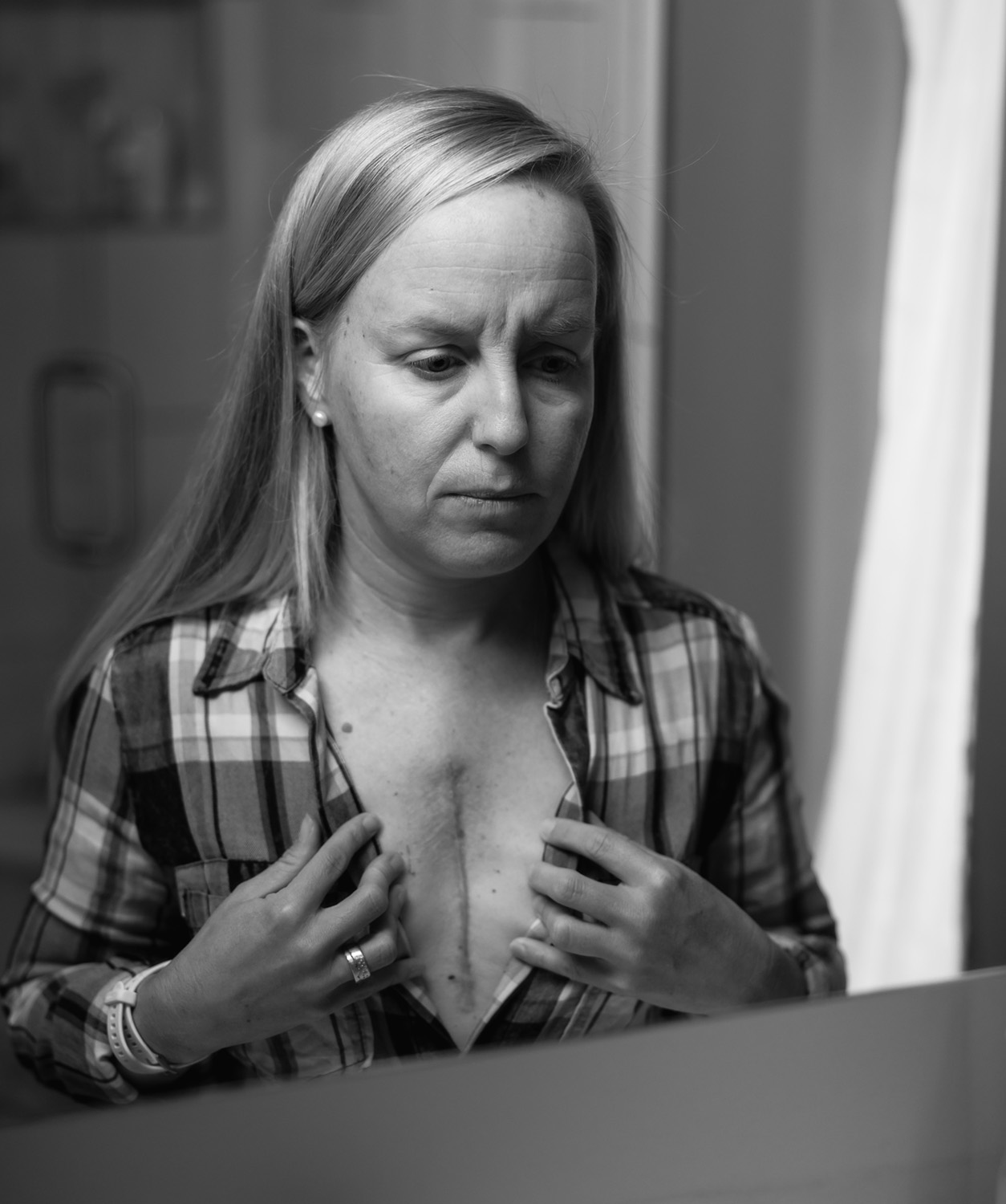 Suzanne Boots Knighton stands in front of a mirror and examines a large scar that extends down the center of her chest.