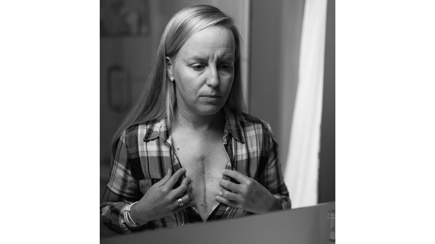 Suzanne Boots Knighton stands in front of a mirror and examines a large scar that extends down the center of her chest.